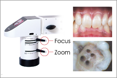 digital dental microscope system rfsystemlab - magnification factor
