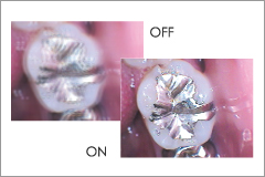 digital dental microscope system rfsystemlab - image stabilizer