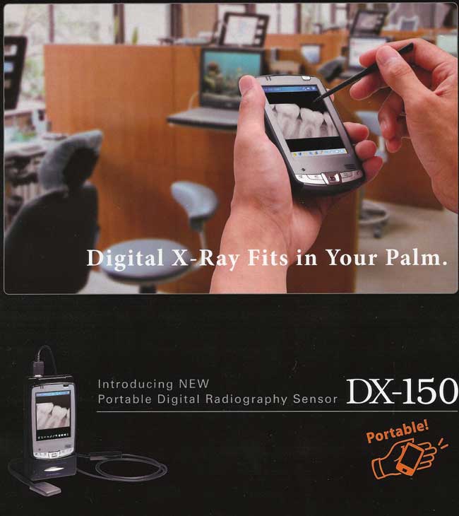 portable-digital-dental-x-ray-sensor-DX-150-1.jpg