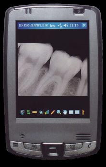 portable-digital-dental-x-ray-sensor-DX-150-2f.jpg