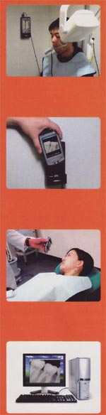 portable-digital-dental-x-ray-sensor-DX-150-3b.jpg