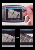 portable-digital-dental-x-ray-sensor-DX-150-3f.jpg