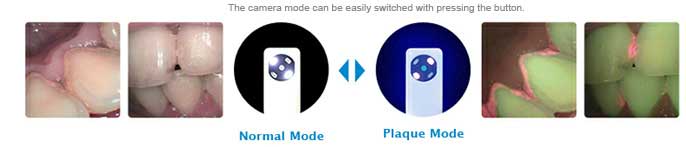normal mode and plaque mode