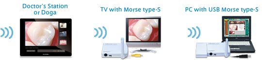  Rf SYSTEM Lab wireless dental camera and monitor system